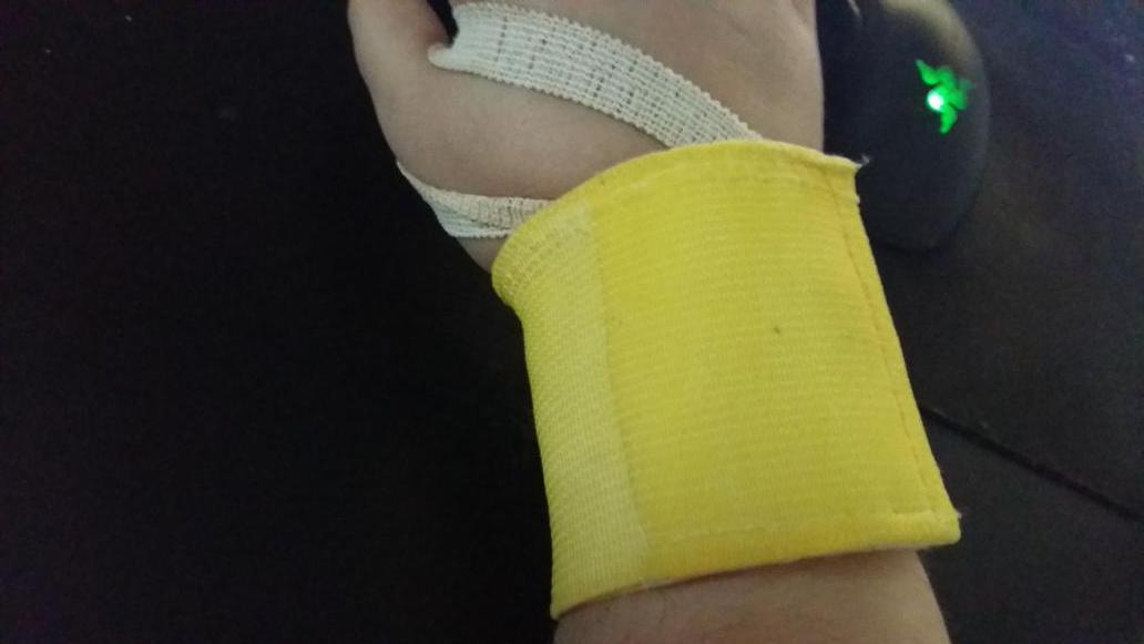 xoxetteh's tweet photo. Lesionada y nose ni como t.t #lesion #mueca #dolor #vicious #razer #amarillo #chras #triste #xoxe #xoxeteh #xoxo http://t.co/FweDJljyZ3