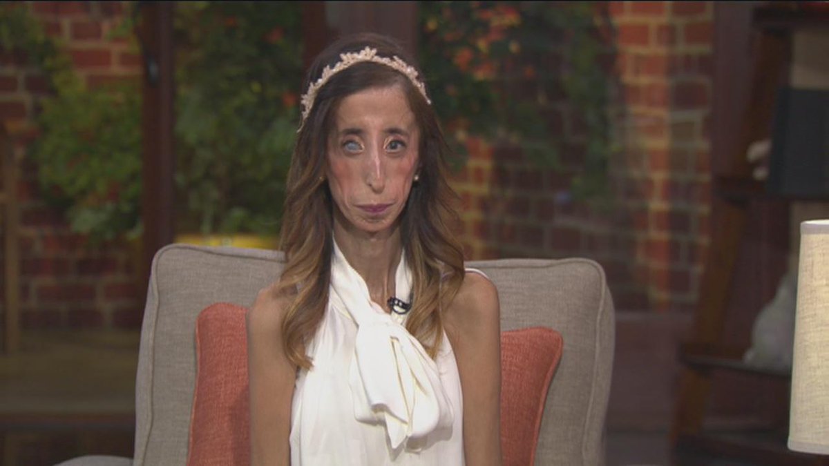 INTERVIEW:<a href="/ImWithLizzie/">A Brave Heart Film</a> Lizzie Velasquez fights bullying with new documentary ‘A Brave Heart' foxla.com/good-day/good-…
