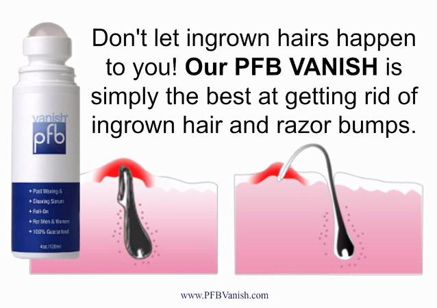 Pfb Vanish Usa On Twitter Tired Of Those Ingrown Hairs Try Our