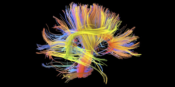 Nature's tweet image. Brain’s wiring patterns can shed light on a person’s positive/negative traits #connectome ow.ly/SLoL4