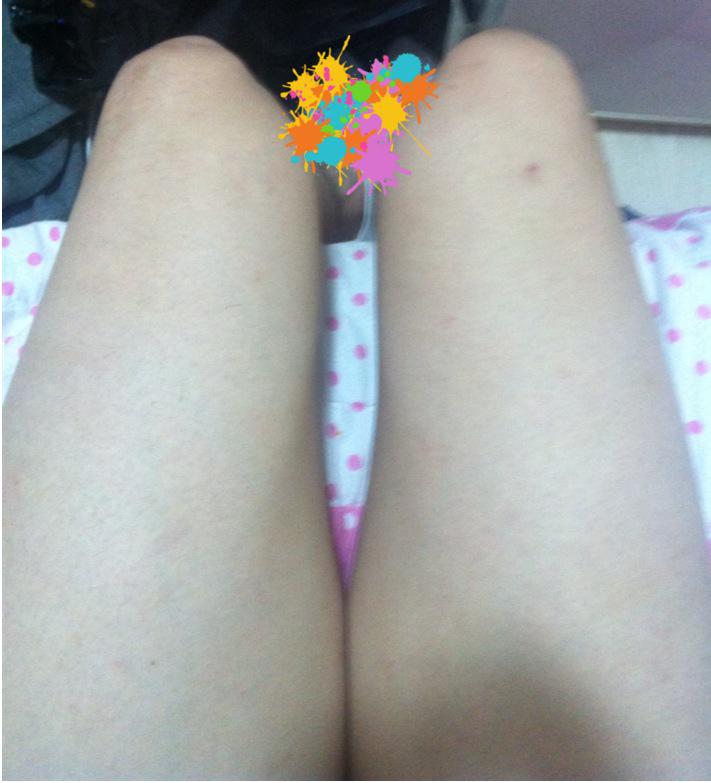 8Sdgq's tweet photo. 깨끗한 다리.. 맷자국을 이쁘게 새겨넣고 싶다. http://t.co/fbu6J6w8et