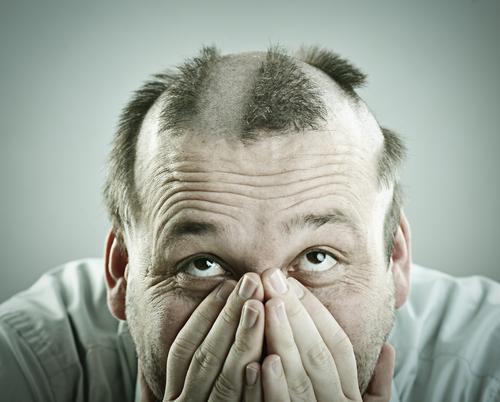 AddToYourBasket's tweet photo. The real reason for losing your hair ...http://t.co/YhpOv2xXf6 http://t.co/azIjlhjoZE