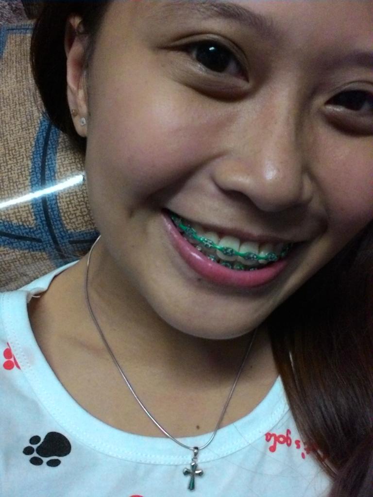 xsmabx's tweet photo. Bye dark red, Hello GREEN! ๐
#Adjusment
#Rubber
#Green
#VSCO http://t.co/TZ6rUFIFd6