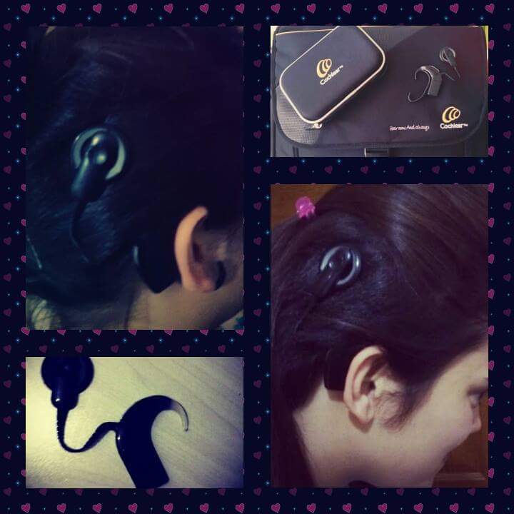 emlaykuttt's tweet image. #cochlearimplant #cochlear2015 ..  😍😍
