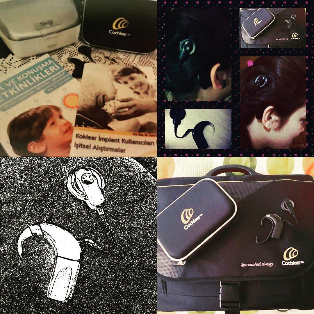 emlaykuttt's tweet image. #cochlearimplant #cochlear2015 ..  😍😍