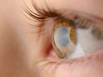 Atasi Mata Silinder Secara Total dengan Lasik de.tk/6gPb0I via <a href="/detikHealth/">detikHealth</a>