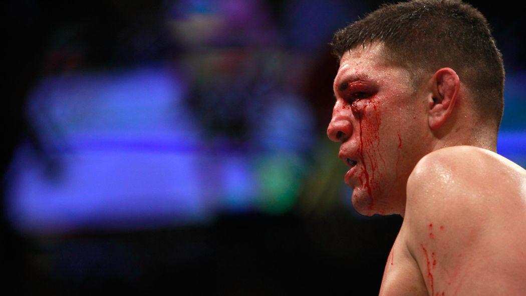 BloodyElbow's tweet photo. UFC anti-doping rep Jeff Novitzky tells @JoshSamman that NAC got Diaz case wrong http://t.co/cPGrk3aWml http://t.co/OTO7bMQ0cw