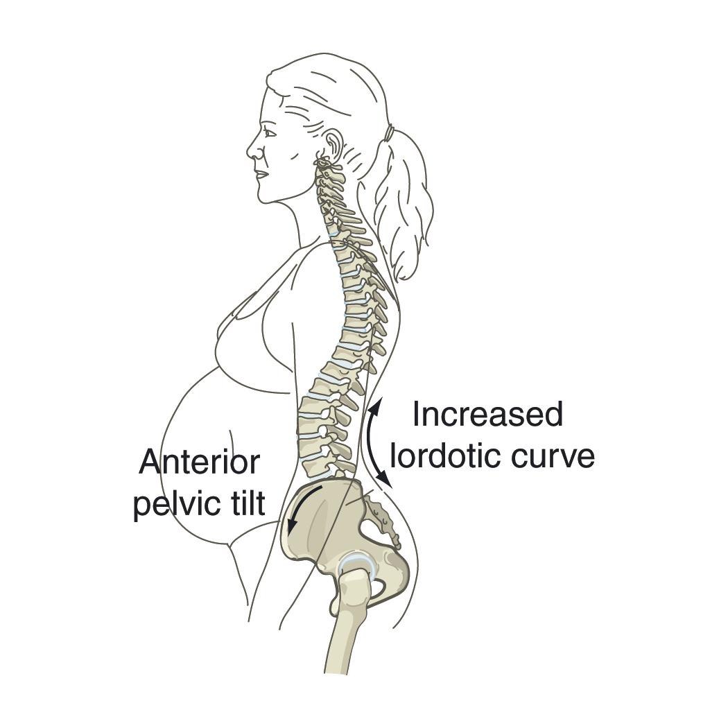 PhysioDublin's tweet photo. Read how to stop lower back pain in pregnancy http://t.co/6m3g5py9YU #physio http://t.co/cs0Ssc2FvS