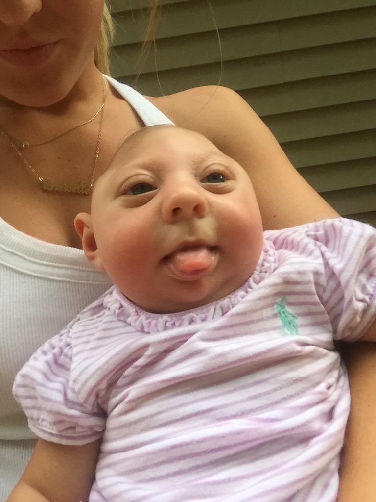 lorrieee_22's tweet photo. So thankful for this little miracle! #microcephalyawarenessday http://t.co/euKm9KHsAr