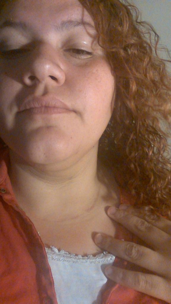 KpopsNoona's tweet photo. I put a smile on so people don't see what I go through, but don't judge me. My scar from my surgery cus of my cancer. http://t.co/n45QD1QZkV