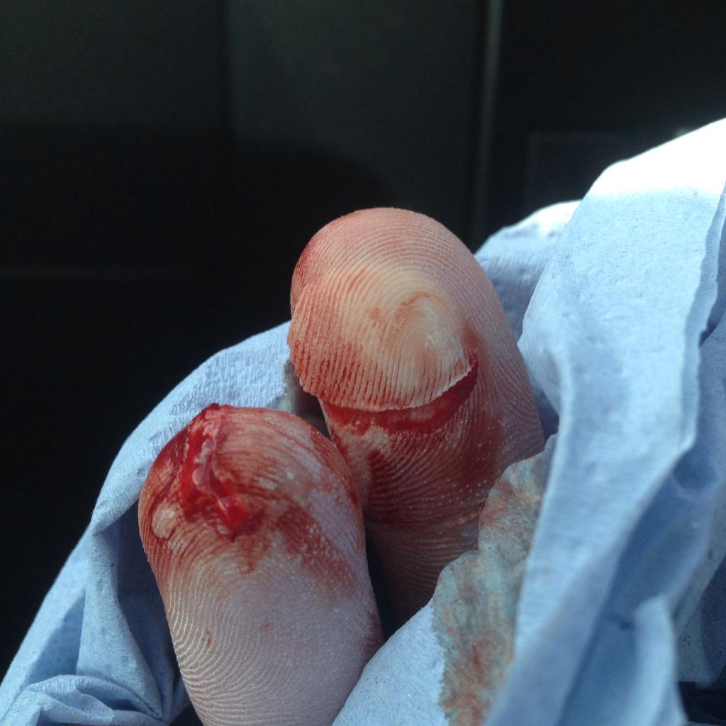 FelgateShane's tweet image. 