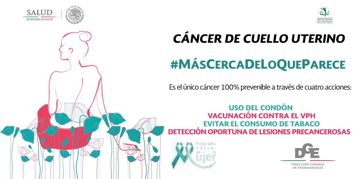 HRAEIxtapaluca's tweet image. #SaludDeLaMujer
#JuevesFollowUs