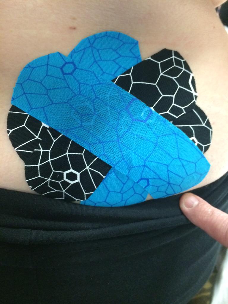 AppleTreeMT's tweet photo. S/I joint stabilization #CMC15 #learn2tape http://t.co/7Dp883Erfk