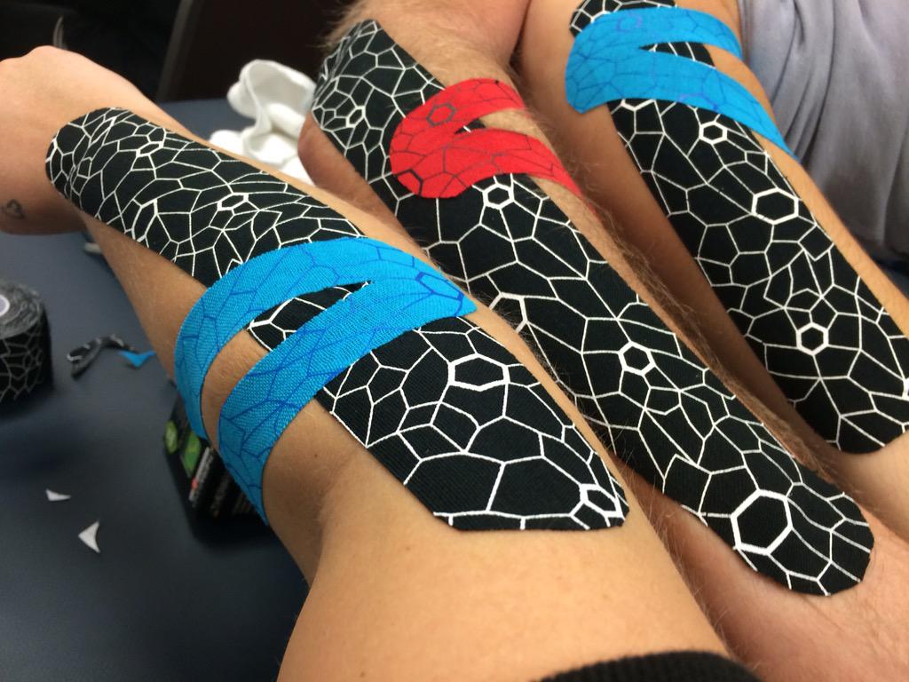AppleTreeMT's tweet photo. Lateral Epicondylitis #CMC14 #learn2tape http://t.co/D5r8CEZccA