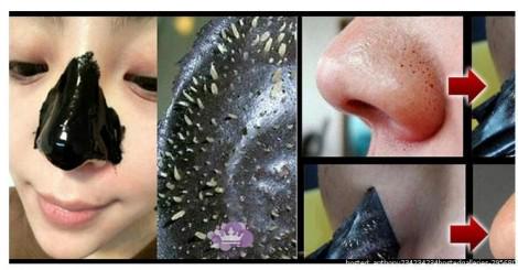hiddenfactmsgs's tweet photo. How To Get Rid of Blackheads Overnight>>http://t.co/Zz2Ug3HxpQ http://t.co/sBdeEuzfzx