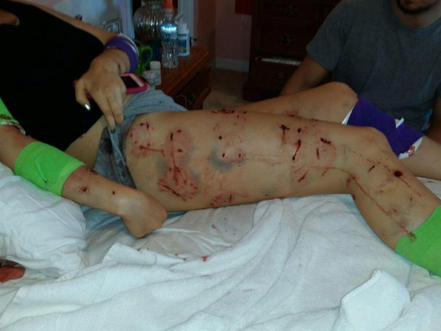 wrtv's tweet photo. FULL STORY: Woman still in critical condition after pit bull attack in Carroll Co.  -http://t.co/0kUxBFPSNY http://t.co/ntPUJa56Ul