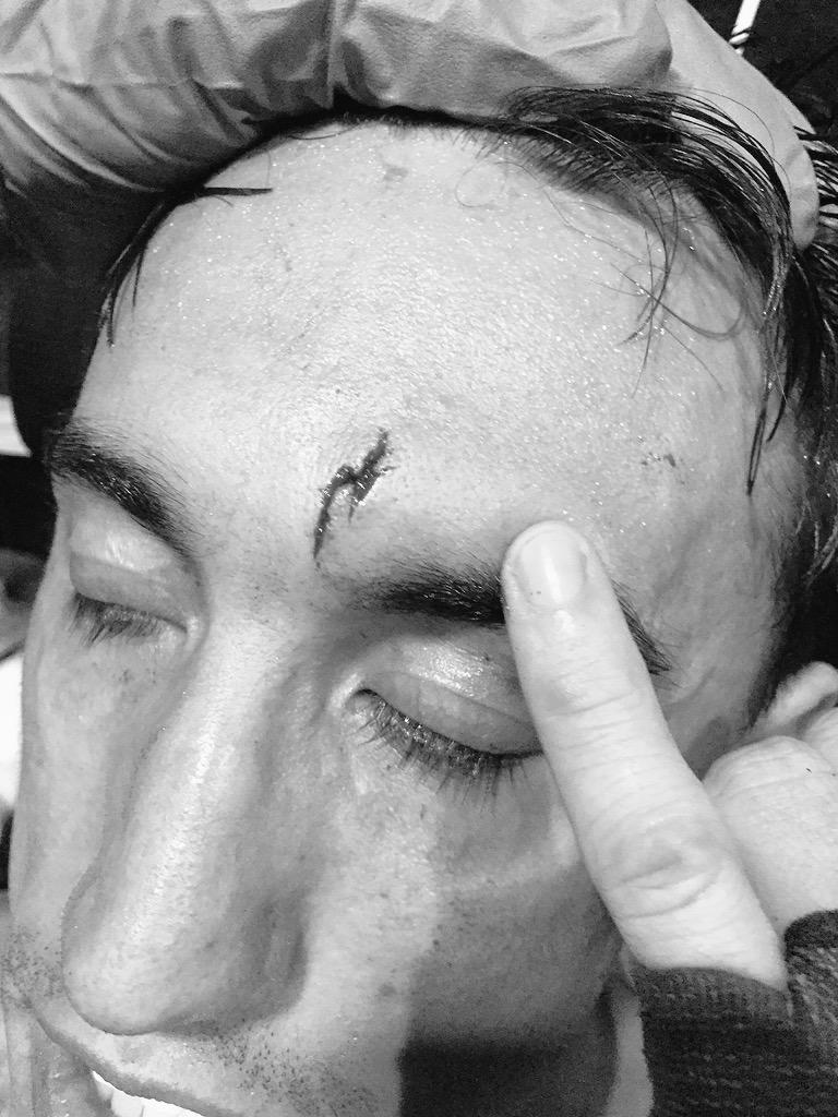 Oroubro's tweet photo. I chose to be Joey Potter in my fight last night #harrypotter #lightningscar #muaythai #thai #kickbox #mma #bjj http://t.co/h2O6BIf9LP