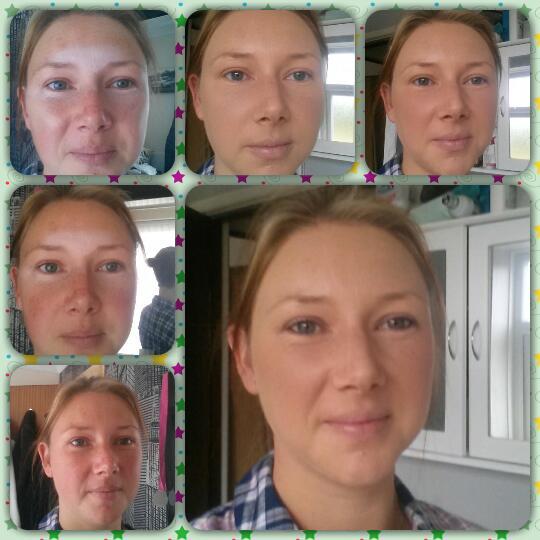 Hollylt85's tweet photo. my try at contouring #loveActiDerm http://t.co/xm3o8RHGTG