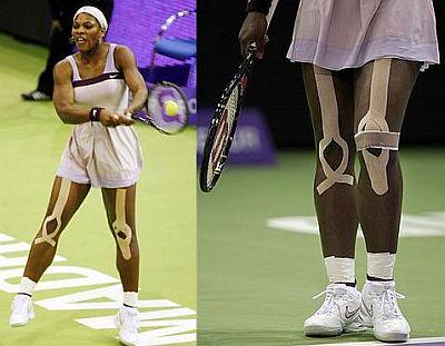 osteopatinoa's tweet photo. S.Williams da kinesio tape kullanarak sağlık sorunlarının performansını etkilemesini engellemek isteyenlerden #sağlık http://t.co/rOlEr5qfd6