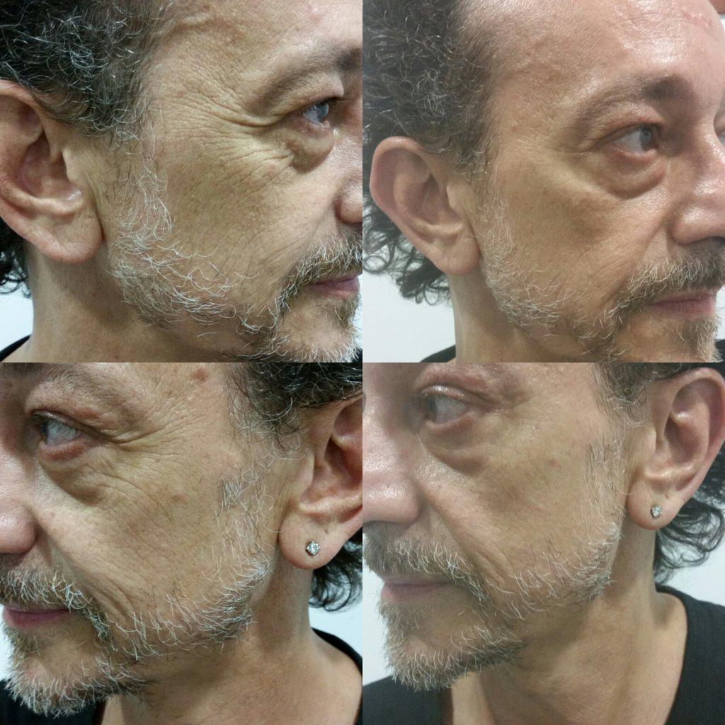 CodiMagic's tweet photo. It Works Wrap facial 45m' más solamente
#loliissima #codimagic 932700700 http://t.co/Sm6b9I4gis