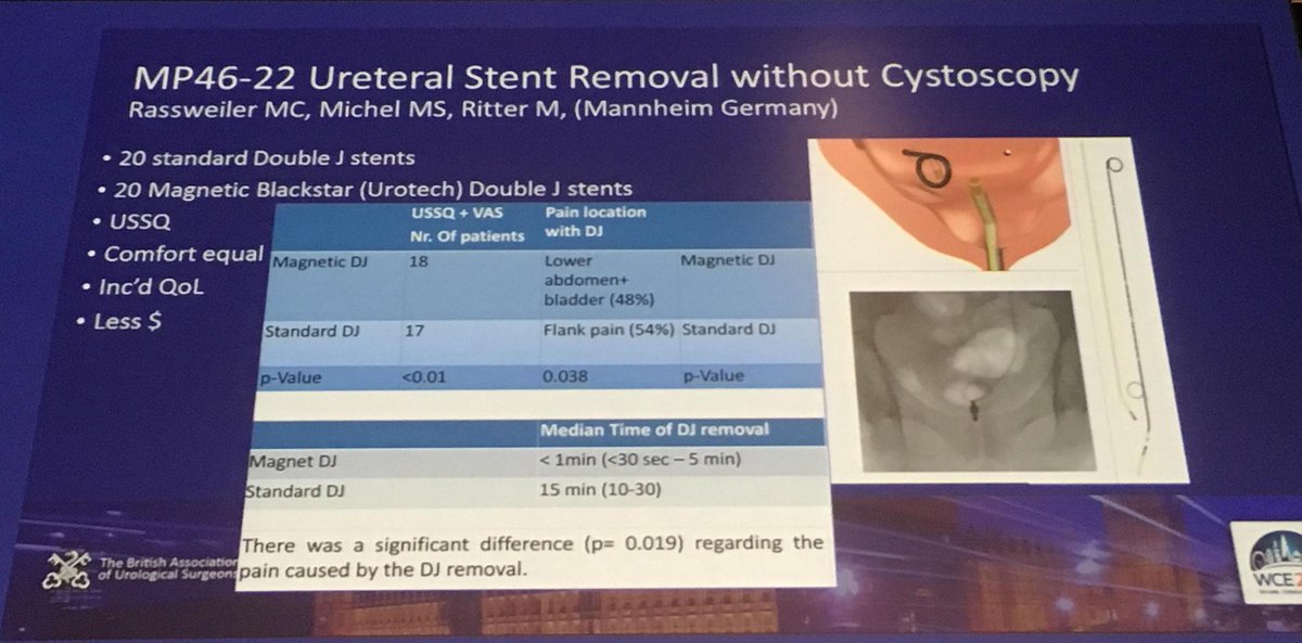 OJWiseman's tweet photo. #wce15 more stone highlights for those not able to stay. Stent with magnet on end may make for easier removal http://t.co/ItQG5orngv