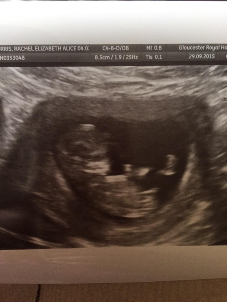 Rachel Morris tweet media