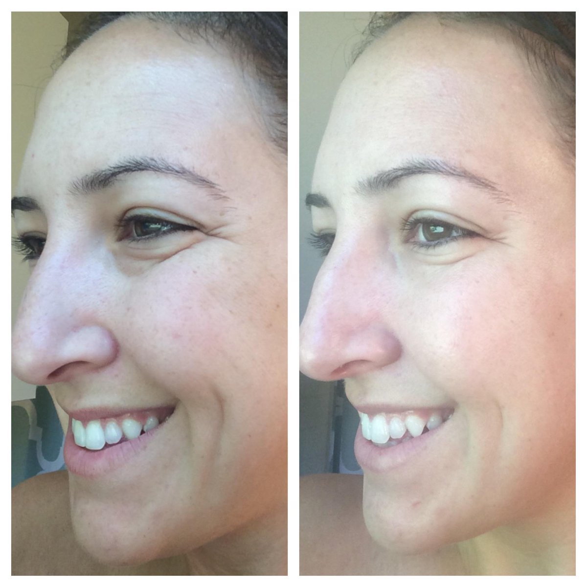 ShariDell313's tweet photo. This is me with my one week results!! Interested?! Message me today!! http://t.co/MKAGBI4YwZ