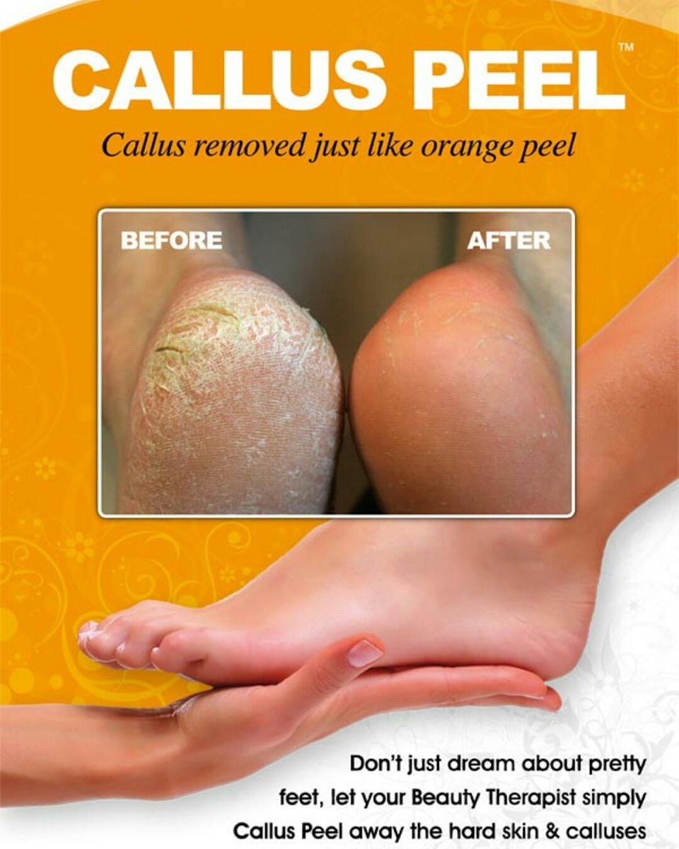 Salon_Beauty1's tweet image. #calluspeel #cuffleysalon #opennovember #booknow sazsel.co.uk