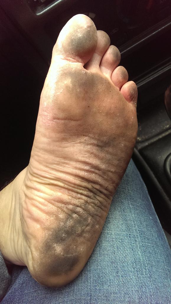 NLSolesexpert's tweet image. Walking barefoot in den haag city