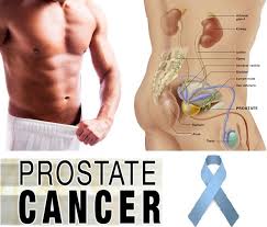 TheProLogic1's tweet photo. Symptoms of #prostatecancer 
Having to rush 2d toilet 2pass #urine 
@Gidi_Traffic @TrafficChiefNG @NigeriaNewsdesk http://t.co/kVdaDSwlid