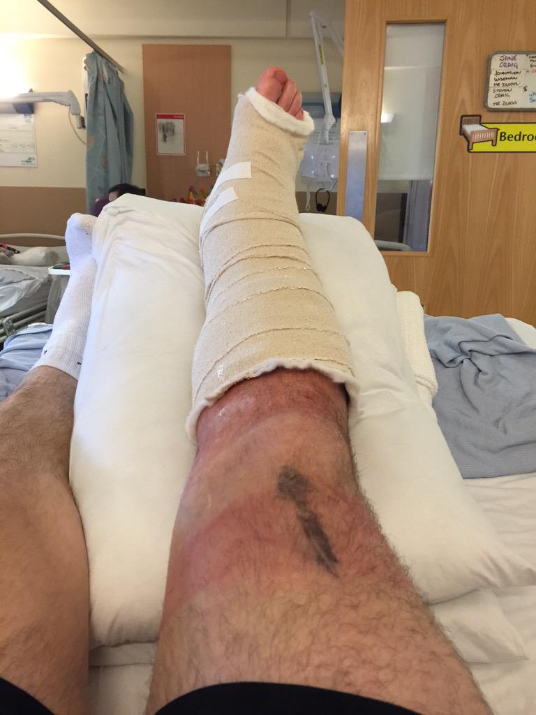 stuartyoung5's tweet image. Can we get a shout for for out m8 Stevie since he is missing 2nite as he broke his ankle on sat #wholedifferentstory