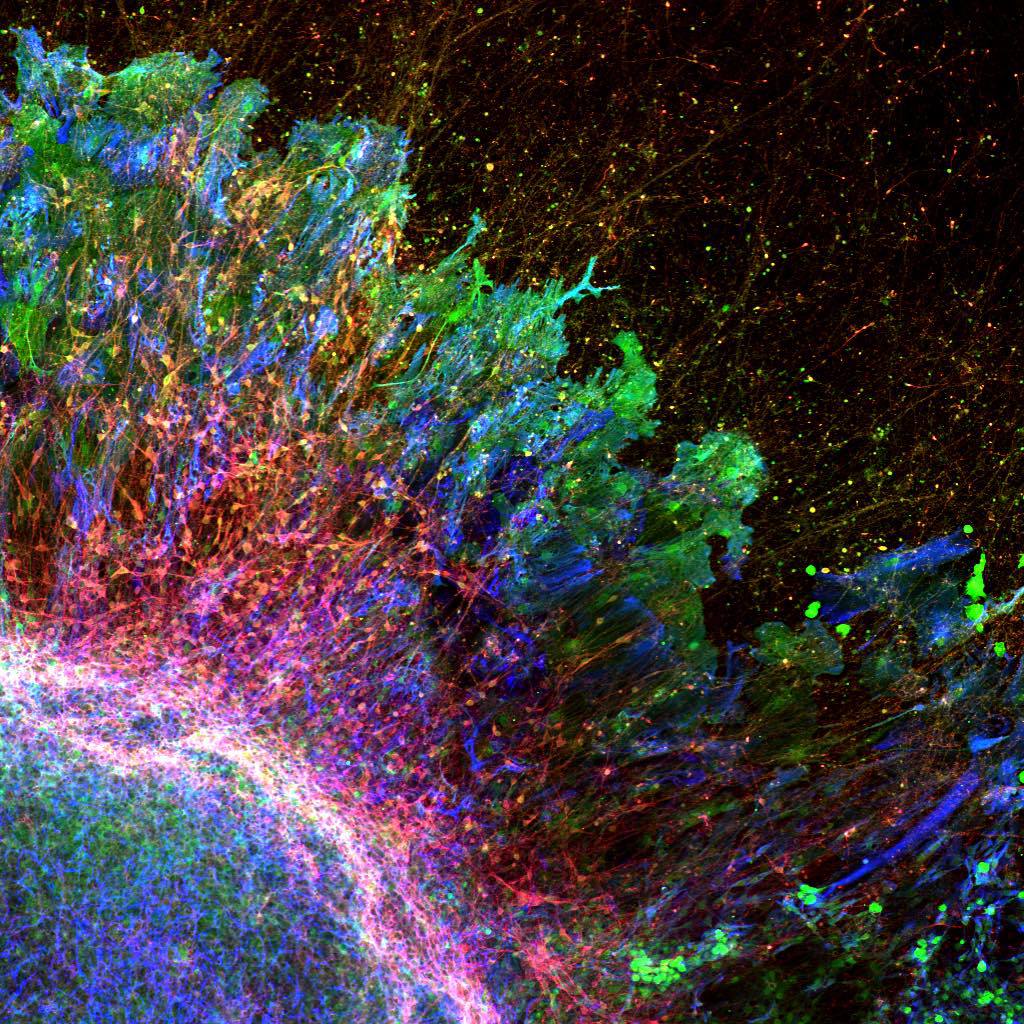 Paul Knoepfler (@pknoepfler) on Twitter photo Congrats to #stemcell image contest winner: Tina Zimmerman ipscell.com/2015/10/stemco… Congrats to #stemcell image contest winner: Tina Zimmerman ipscell.com/2015/10/stemco…