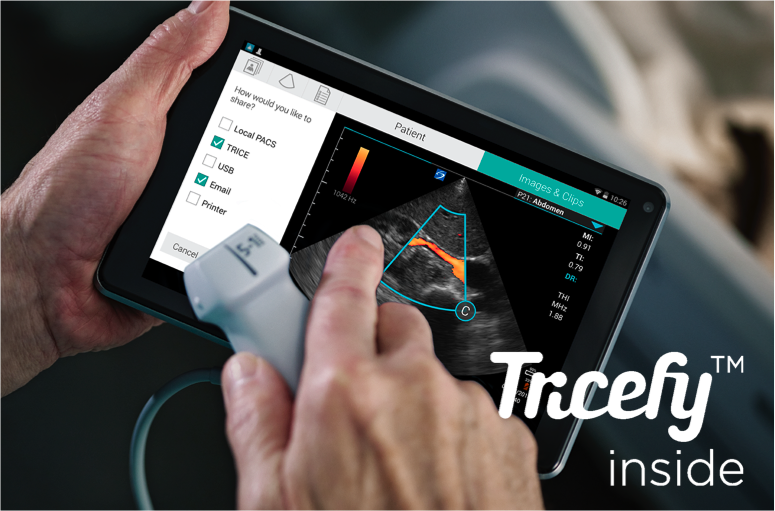 Trice_Imaging's tweet photo. Excited to announce the Tricefy embedded iViz http://t.co/X3wzydzYhJ with @sonosite @ #health2con. #ultrasound http://t.co/JHDlm47uCO