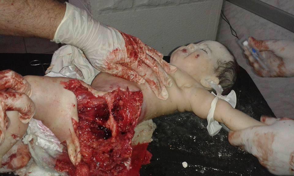 PalmyraPioneer's tweet photo. Victims of Russian planes bombing on #Syria #PutinCrimes #RussiaBombingSyria #USAccomplice #RussianAirStrikes http://t.co/AFOwc2fDMv