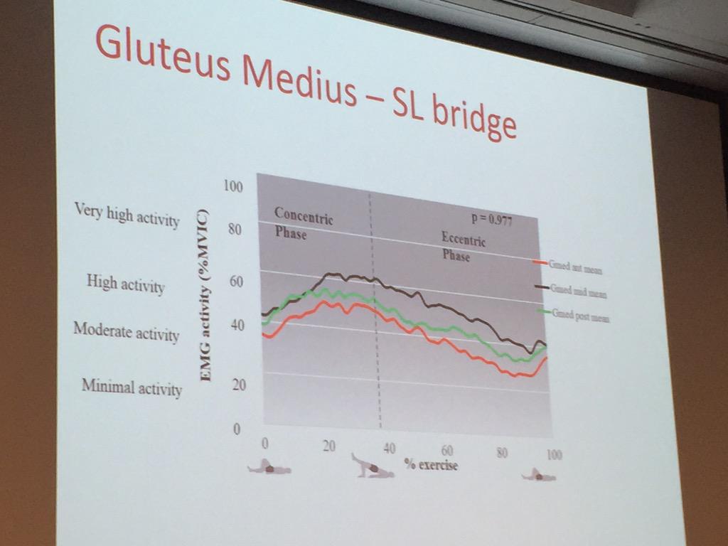 alisongrimaldi's tweet image. Damien Moore @ASemciw SL bridge &amp;amp; SL squat both elicit good recruitment of all segments of GMed #APAConnect2015