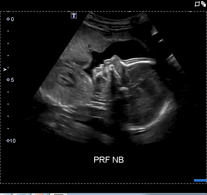 StJoesFdnTO's tweet photo. Thank you to our sonographers -- a vital part of our team advancing the health of our community #SonographersWeek http://t.co/jWsk5vyHMV