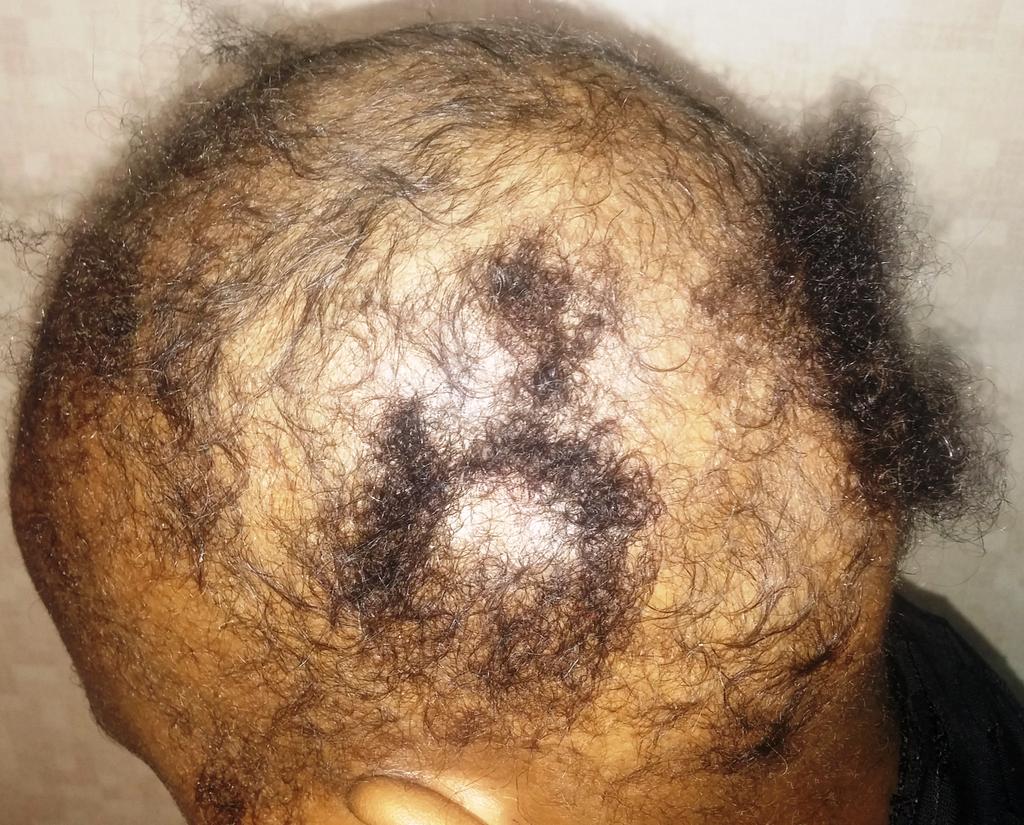 HairHub_'s tweet image. Amazing #ClientTestimonies from local customers of #HairGrowth at #Hairhub