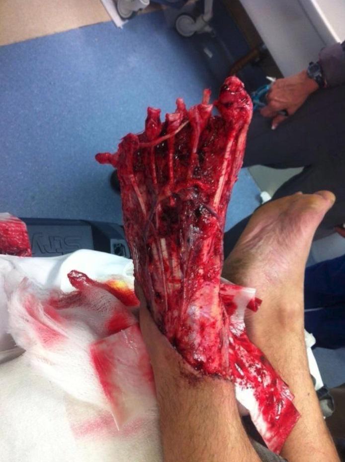 AmedioConD's tweet photo. Ey! @ElMedicoLoco tienes una tirita? http://t.co/ZmQwhOhvbf