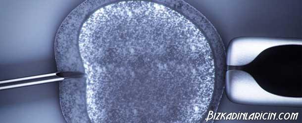 ACGH Kapsamlı kromozom  ... - bizkadinlaricin.com/acgh-kapsamli-… - #ACGHUygulaması #EmbriyoTransferi #Gebelik #Hamilelik