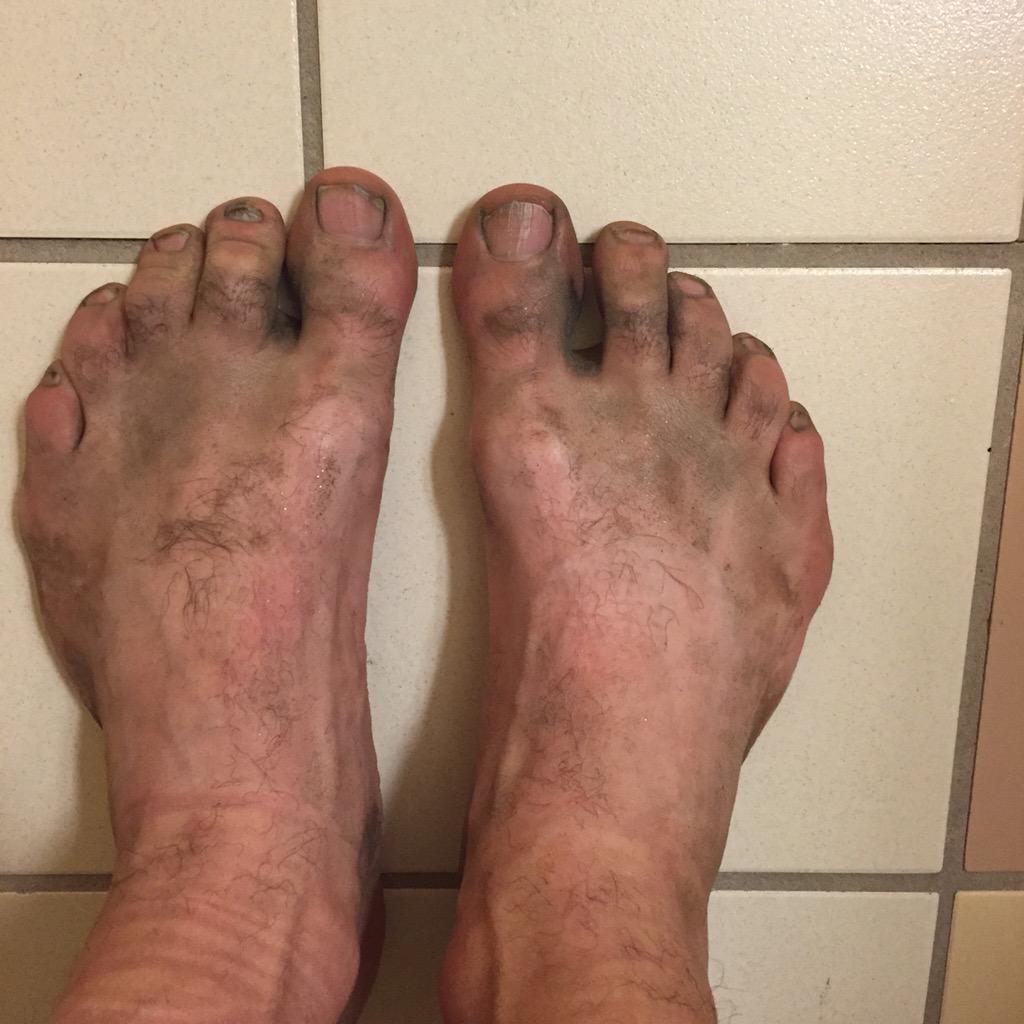 OptimusJoe72's tweet photo. Who can relate! #runningproblems #ocrproblems #running #ocr #obstaclerace http://t.co/7jQaowcaoQ