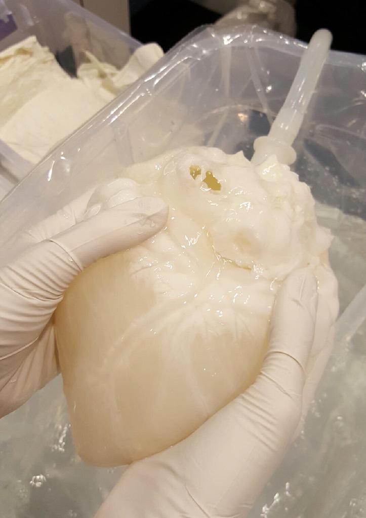Decelluarized #heart! New innovations in #organ #transplant technology. #ACSCC2015 #CCR2015