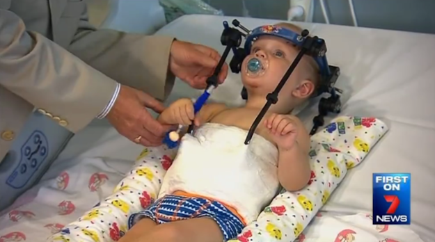 BuzzFeed's tweet photo. A toddler’s head was reattached to his spine after a horrible car crash http://t.co/D3NJH32zlb http://t.co/j8s3kNFNvq