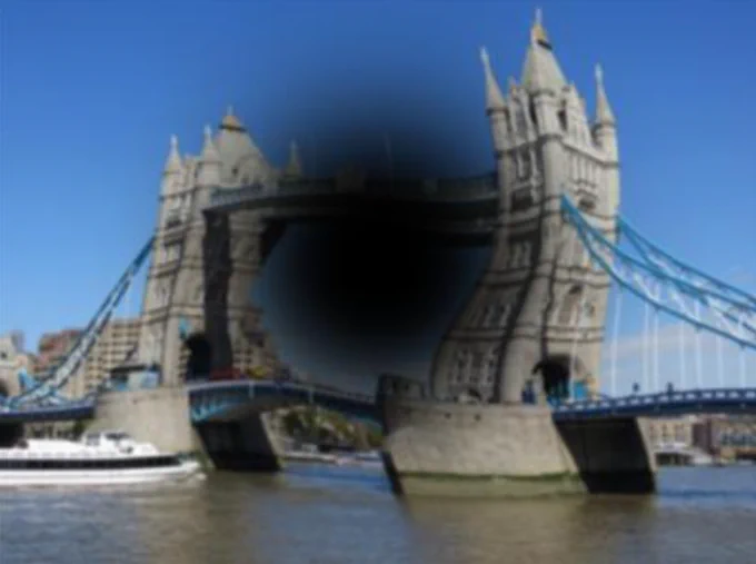 Image from London Eye Hospital (@EyeExpertUK)