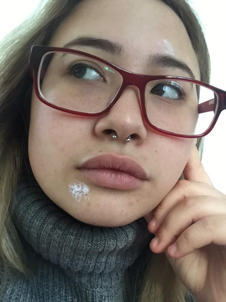 _shannonaimee's tweet image. #pimpleproblems