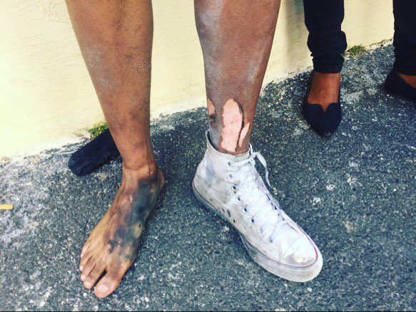 MapsMaponyane's tweet photo. Shot at for wanting education. This is what it's come down too 💔 #NationalShutDown #FeesMustFall https://t.co/vpdsaoQwul