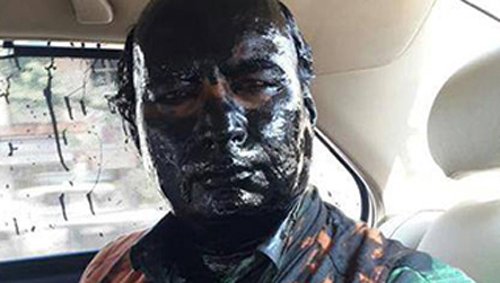 DailyO_'s tweet photo. 6 ways in which ink can actually help #ShivSena | https://t.co/vOXeDfU0Gz | #InkAttacks #SudheendraKulkarni https://t.co/SQV2N2VtQH