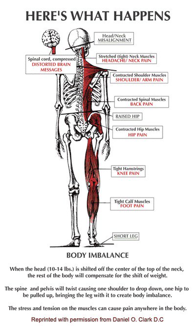 FixUpmassage's tweet photo. Another visual to show the bodies interconnections. Your short leg could be coming from your head tilt. https://t.co/AGcmKDQKKp