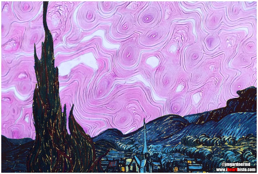 ASDPTweets's tweet image. MT @IHeartHisto: The Ichthyotic Night 
by @IHeartHisto &amp;amp; @JMGardnerMD #dermpath #science #pathology #pathArt