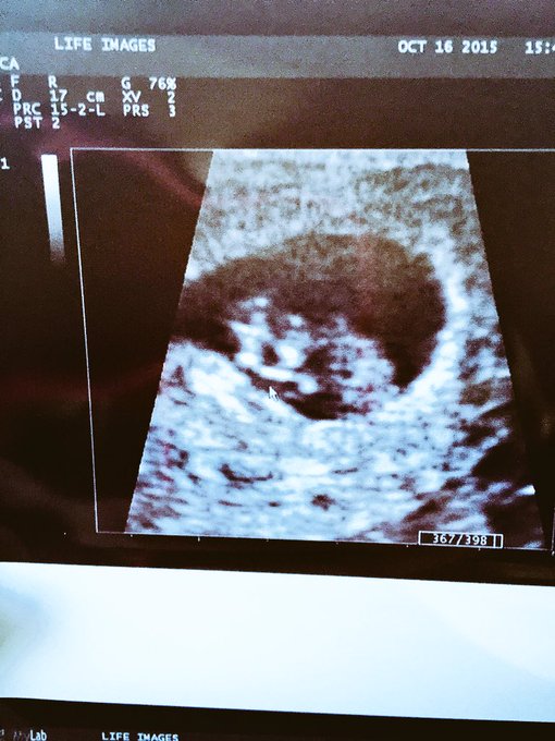 been so long but this little momma is gonna be a momma again #mommy2be #pregnant #pregnancycravings #bunintheoven<a href="/tag/pregnant"class="tags"><span>#pregnant</span></a><a href="/tag/mommy2be"class="tags"><span>#mommy2be</span></a><a href="/tag/pregnancycravings"class="tags"><span>#pregnancycravings</span></a><a href="/tag/bunin"class="tags"><span>#bunin</span></a>