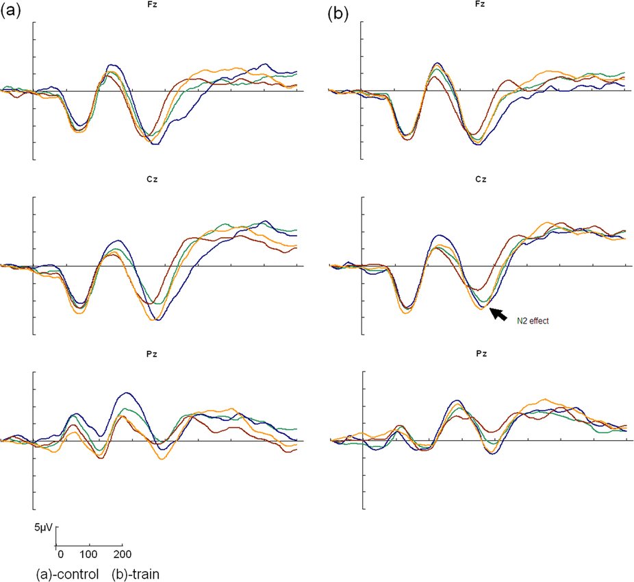 SciReports's tweet image. Study of #preschoolers reasoning ability &amp;amp; #neuralactivity ow.ly/TFHGu #OAWeek2015